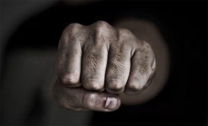 Гродненец сделал ремонт в тренажерном зале и утверждает, что за это ему сломали нос Гродненец сделал ремонт в тренажерном зале и утверждает, что за это ему сломали нос