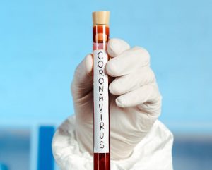 В Гродно откроют вторую в области лабораторию по тестированию на коронавирус. На Гродненщине - новые очаги