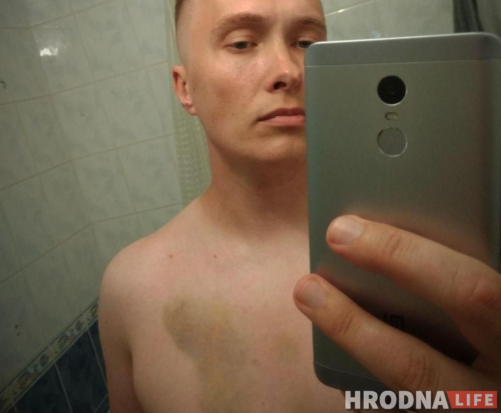 «Фашысты ў кіно — ветлівыя людзі па параўнанні з імі». Бармэн з Гродна, — пра 14 гадзін пасля сустрэчы з АМАПам