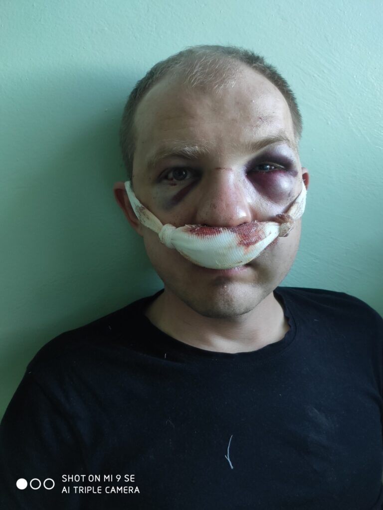 «Толькі адзін выбар — бегчы». Таксіст з Гродна распавёў, чаму не прыйшоў у суд і як апынуўся ў Літве