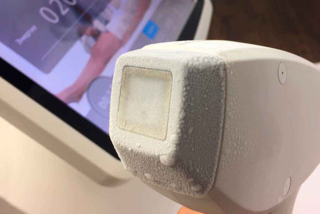 Инновации в эпиляции: возможности современных косметологических аппаратов