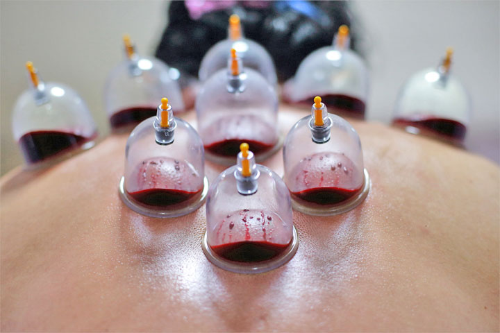 Лекі, атруты і цукеркі. Парады нашых продкаў, ад якіх нам сёння робіцца страшна